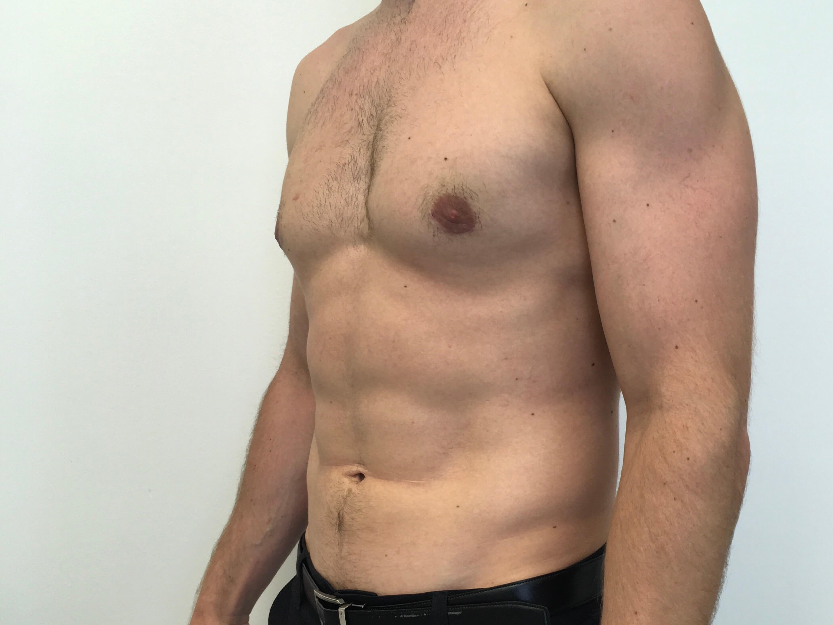 After Image