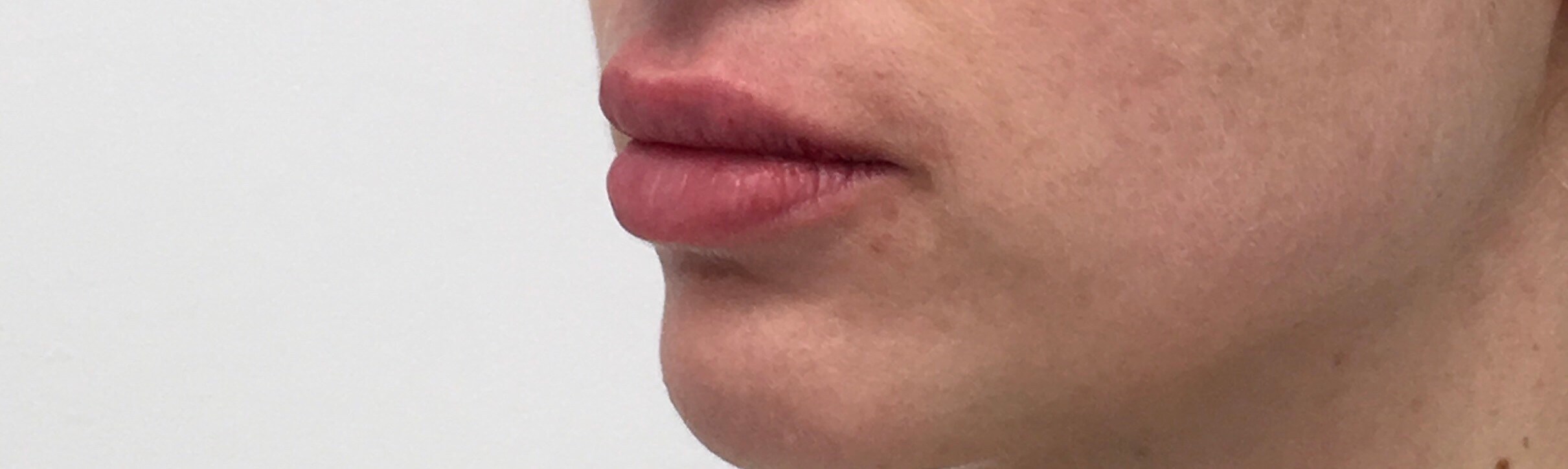 After Image