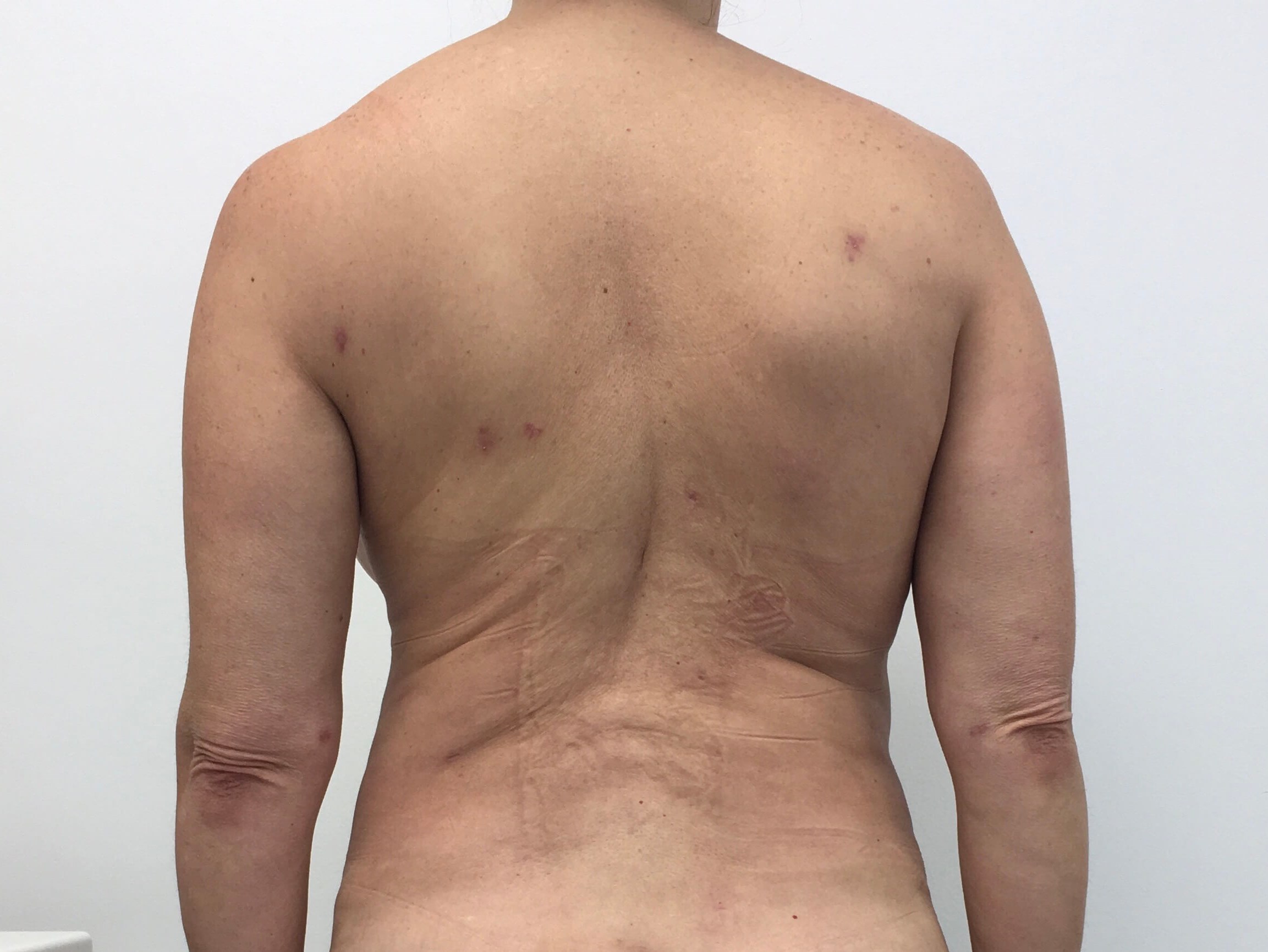 After Image