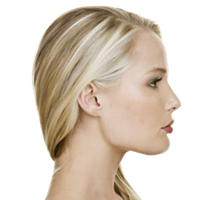 Submental/Jawline Liposuction
