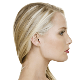 Submental/Jawline Liposuction