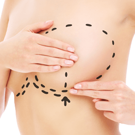 Breast Reduction
