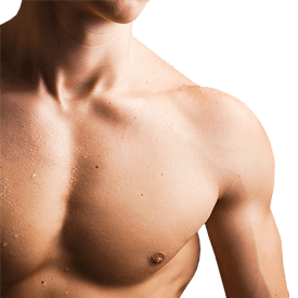 Gynecomastia 